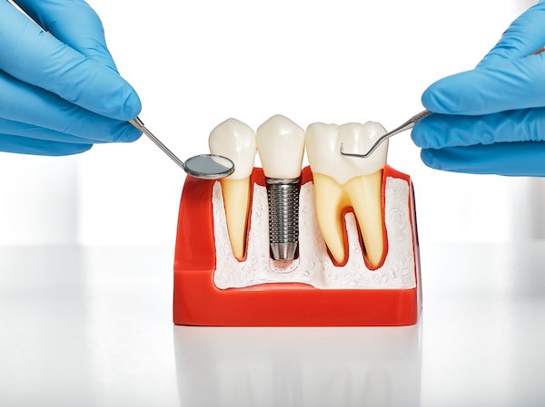 South Wilts Implant Centre